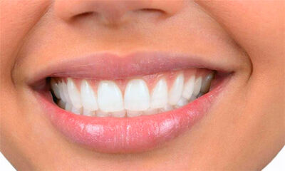 怎么让牙齿变白的方法优质
