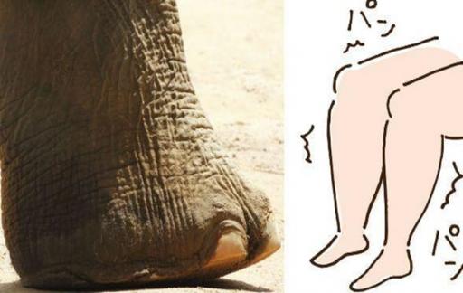 大象腿是怎么形成的