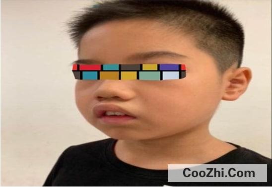 腺样体肥大不要紧吗为什么