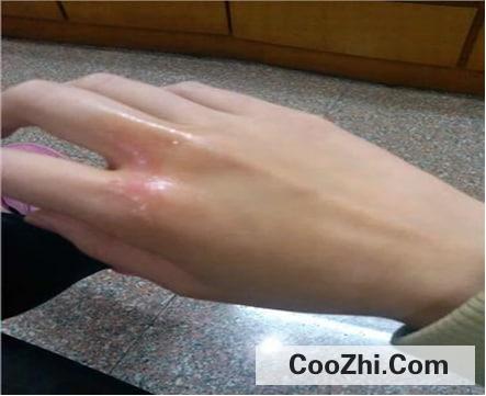 这3类人不能用暖宝宝