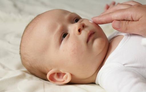 婴儿湿疹与痱子怎样区别
