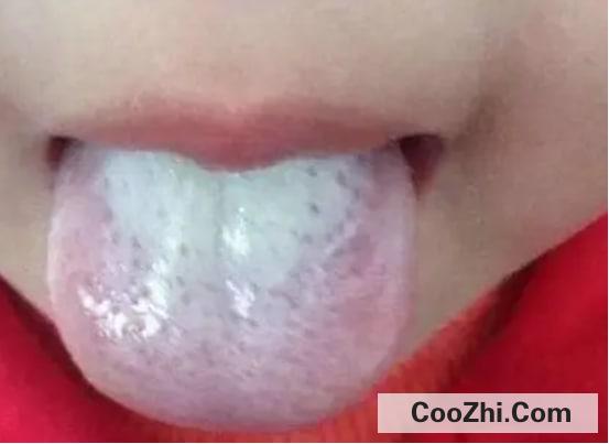 婴幼儿舌苔为什么发白
