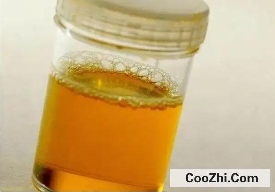 肾不好有哪些表现
