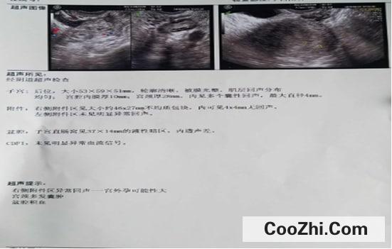 怀孕59天孕酮直线下降的原因