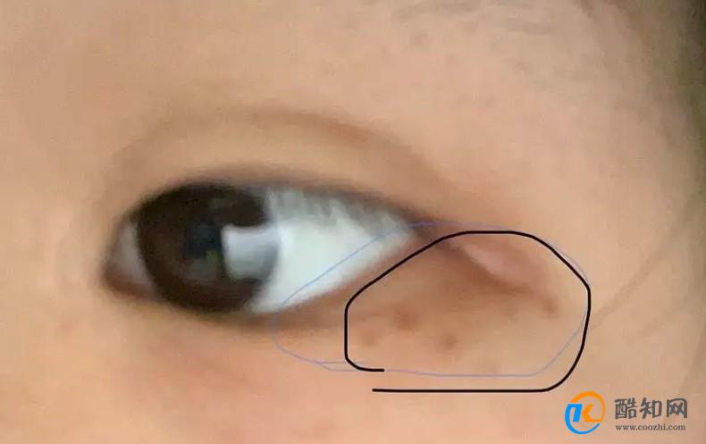 皮革样化是什么意思