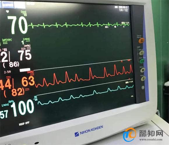 心率正常范围是多少 心率在100到120正常吗