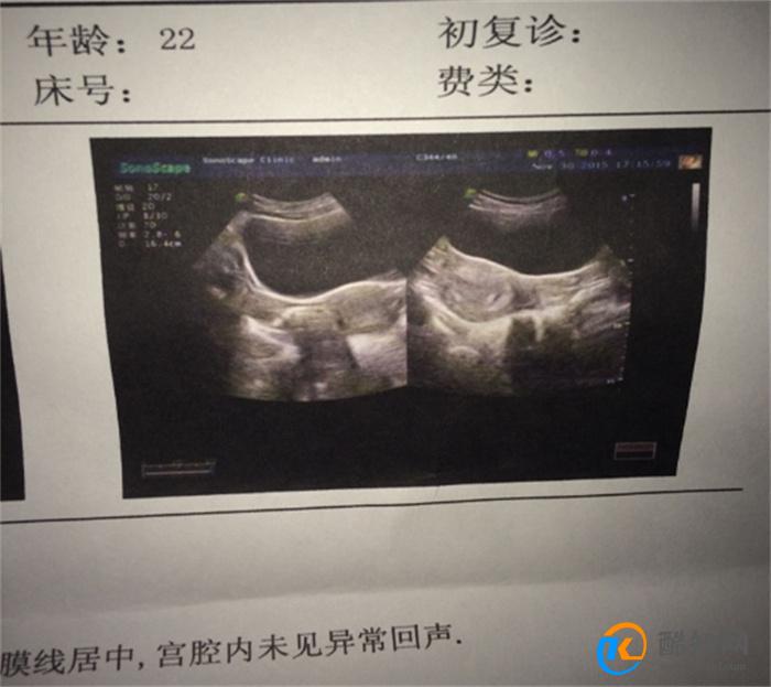 宫外怀孕验孕棒能测出来吗 宫外怀孕怎么处理最好