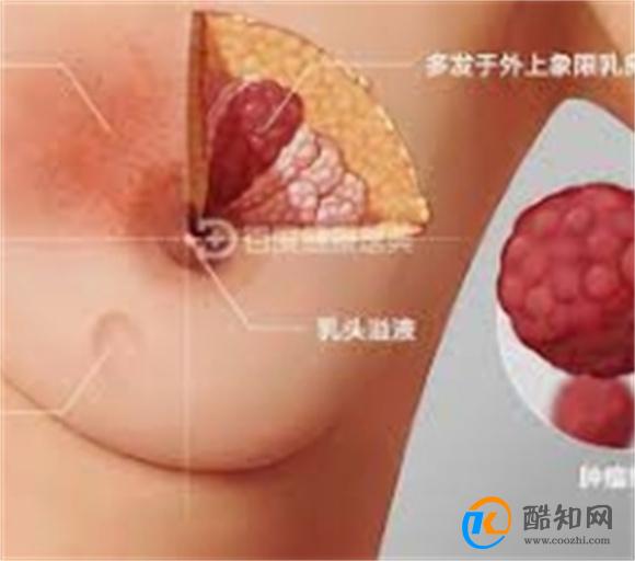 为何女性经常出现胸痛 医生：多与5个因素有关，别不当回事