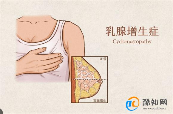 为何女性经常出现胸痛 医生：多与5个因素有关，别不当回事