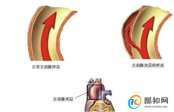 用血压计测量血压，测量左侧准确还是右侧准确？医生一文解释清楚 