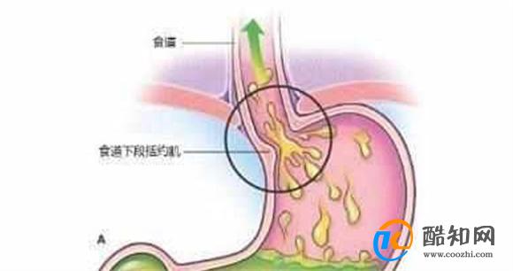 为何女性经常出现胸痛 医生：多与5个因素有关，别不当回事