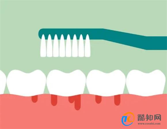 肝脏病变，头部先知？若有4个症状，早做肝CT