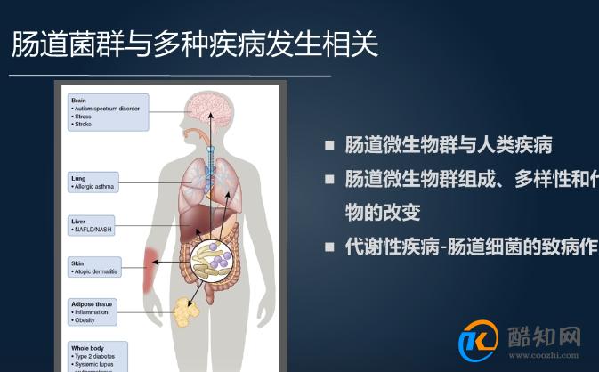 肠道里长了息肉 上厕所时或早有信号 不要等到中晚期才发现