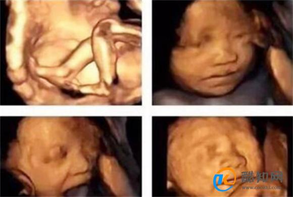 四维彩超的宝宝图片和生下宝宝的相貌有何区别