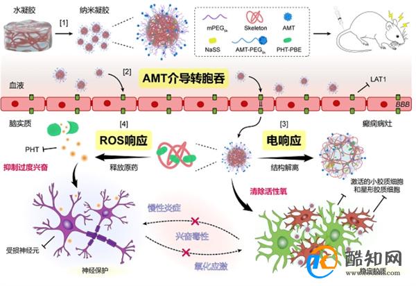 复旦：双响应纳米凝胶靶向癫痫病灶调控异常电环路和炎症微环境 