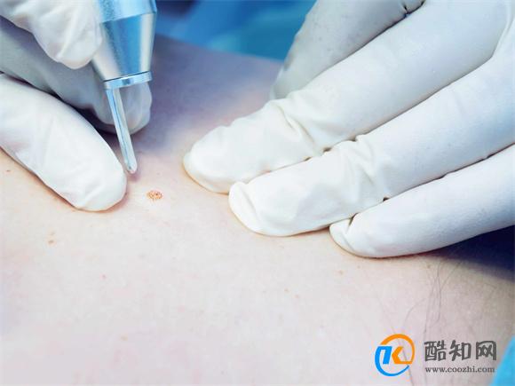 脖子为何会长“肉疙瘩”？医生：多半与6个因素有关 需对症处理 