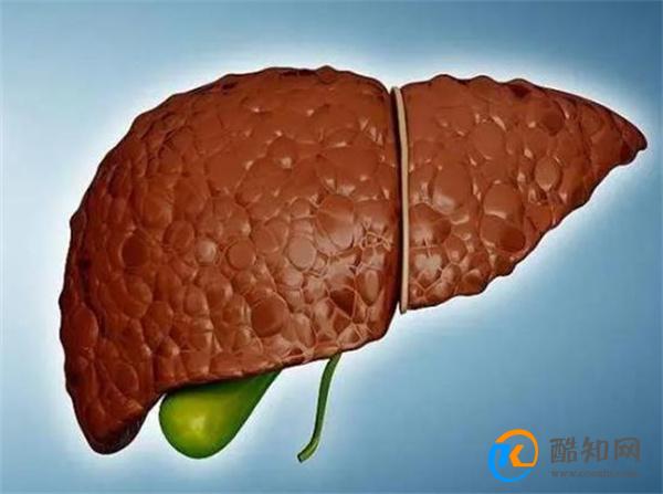 阿司匹林走下“神坛”？医生：这7类人或不适合，早了解不吃亏