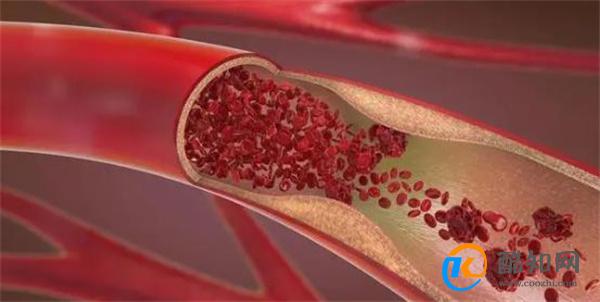 阿司匹林走下“神坛”？医生：这7类人或不适合，早了解不吃亏