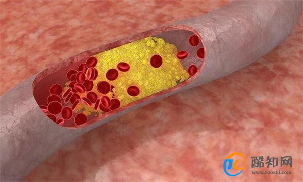 每天走多少步 能保护“血管” 提醒：保持血管干净 做好这5点