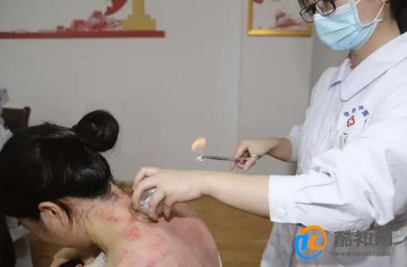拔火罐后的瘀血，是体内的毒素吗？拔罐时间越长越好吗？涨知识了