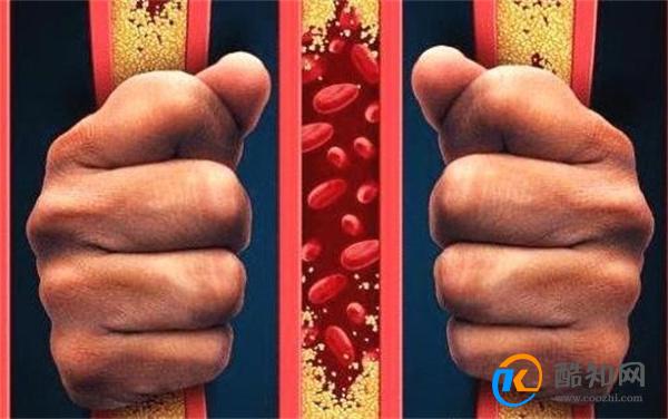 每天走多少步 能保护“血管” 提醒：保持血管干净 做好这5点