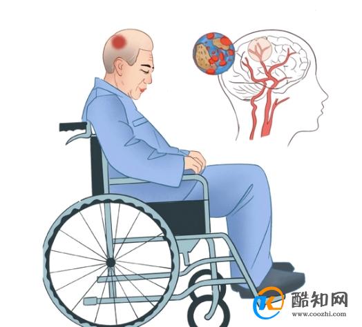 经常“手麻”是怎么回事？多半和3个诱因有关，对照检查一下