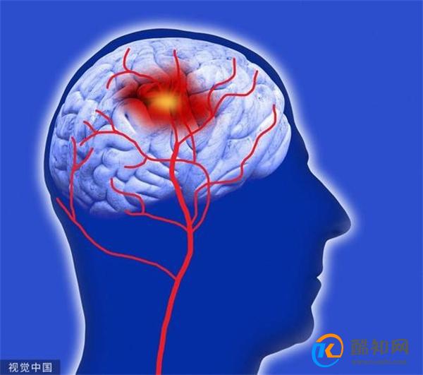 当脑梗来临的时候 会有哪些部位发出预警信号呢 