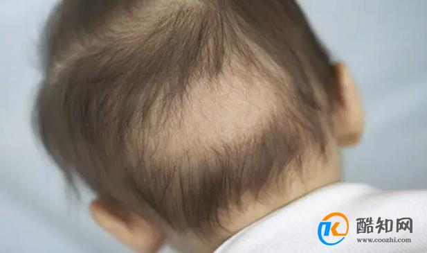 这两种“发型”的宝宝，可能存在发育异常，家长要从营养上下功夫