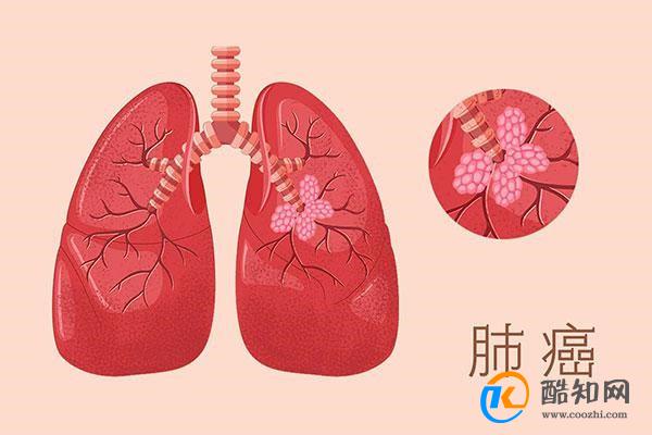 除了肝癌 爱抽烟喝酒的人还会得哪些病
