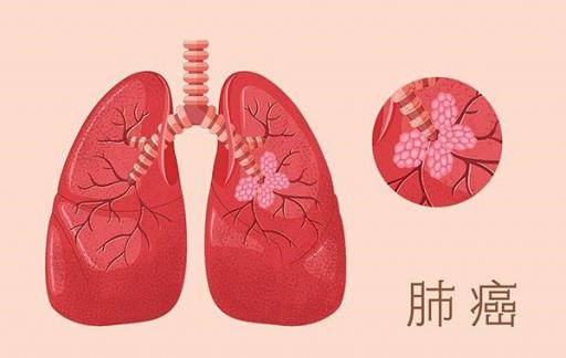 除了肝癌 爱抽烟喝酒的人还会得哪些病