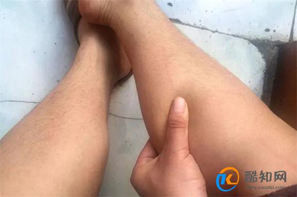 男性肾功能不太行，5种表现跑不掉，基本一眼就能看出
