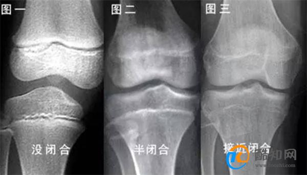 身高遵循“立七坐五盘三”  孩子将来高不高  这个部位一目了然