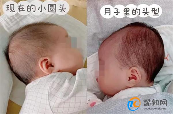 孩子“头圆脑门大”，是聪明的象征？头型不仅关乎颜值更影响智力