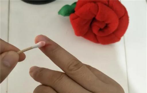 手不小心被划破 这样做可以让您快速愈合 学会赶紧试试 很好用