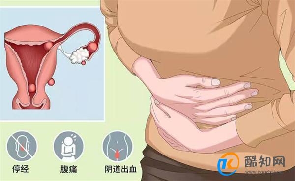 宫外怀孕是怎样引起的 有哪些危害
