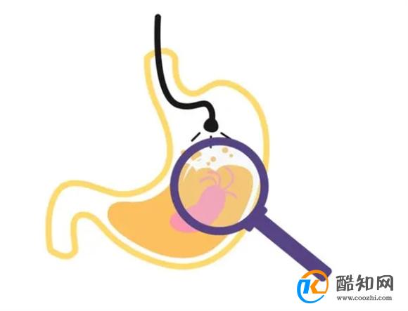 胃癌的出现不痒不痛？若吃完饭后，存在4种异常，或要及时检查