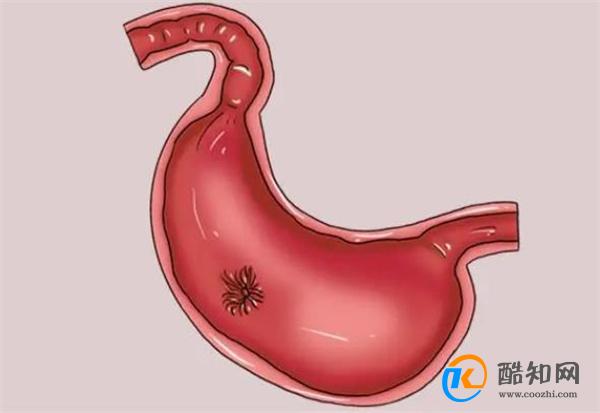 食用油吃错了，或成慢性病“根源”，怎样吃油才健康？牢记3点