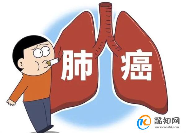 为什么很多肺癌发现已是晚期？这6种症状都在提醒你，却被忽视！