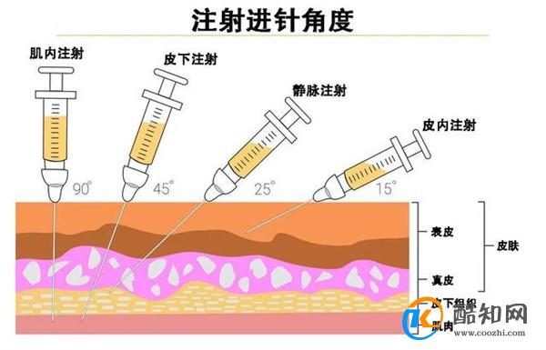 小时候常打的屁股针为何现在消失了 屁股注射为什么特别痛