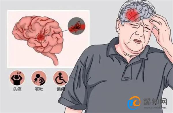 什么是脑梗死？饮食方面，想要预防脑梗死，建议少碰2种调味料