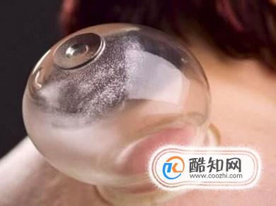 拔罐后要注意什么？