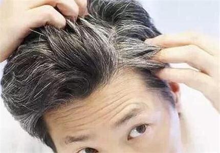 身体缺什么营养会长白发？该如何治疗？