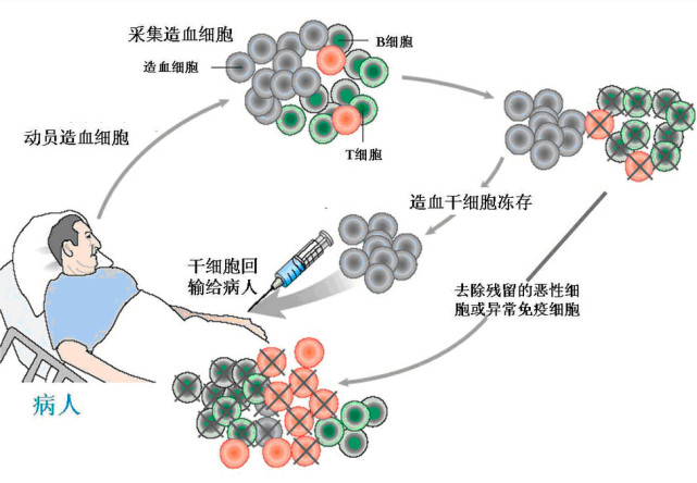 白血病可以预防吗？有哪些办法？