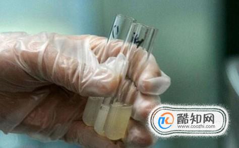 捐精前的准备有哪些