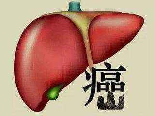 癌症最多能活几个月？哪种癌症活的时间最短？