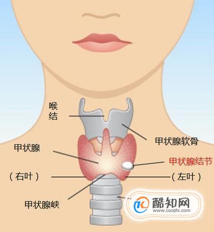 如何定义甲状腺癌 甲状腺癌的早期症状有哪些