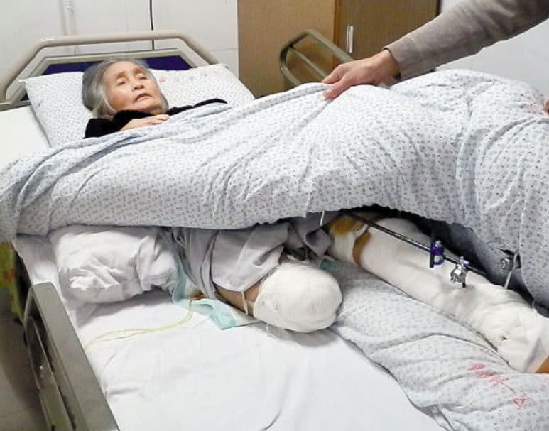 截肢后的肢体去哪里了,把断肢还给患者还是留在医院?