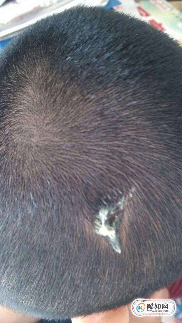 口香糖粘头发上怎么弄掉？