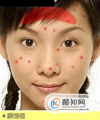 脸上不同位置长痘痘，从痘痘看身体状况！