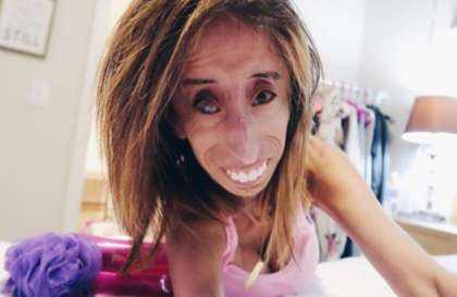 01这名来自美国的26岁女孩丽兹·维拉斯奎兹被称为世界上最丑的女人